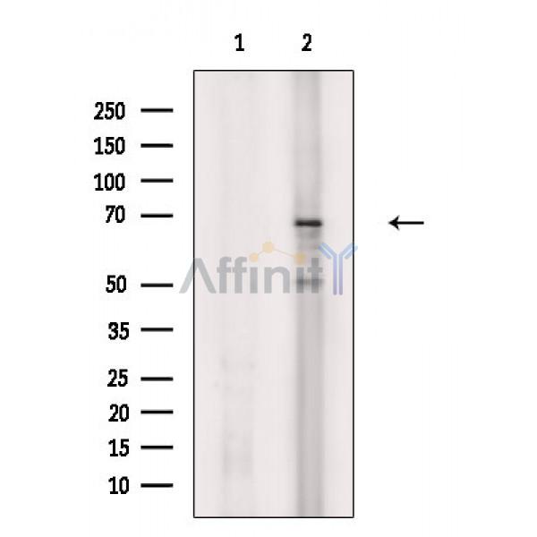 Валидация Affinity AF3946 - 2080