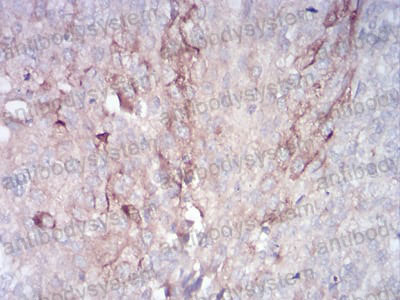 Валидация AntibodySystem RHN94501