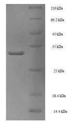 SDS-PAGE