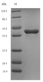 SDS-PAGE