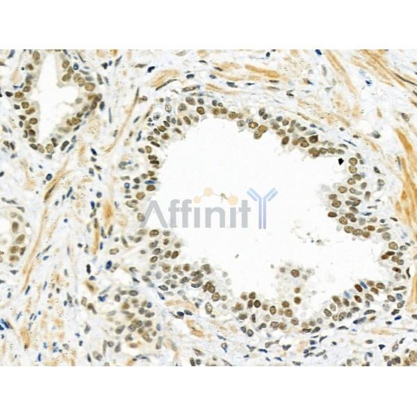 Валидация Affinity DF6257 - 17548