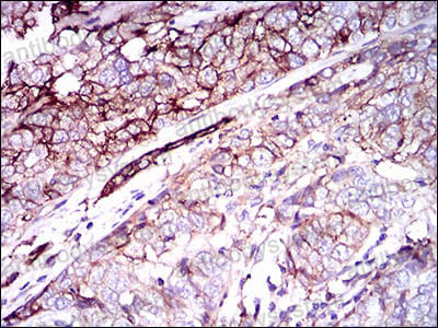 Валидация AntibodySystem RHD02501 (1279)