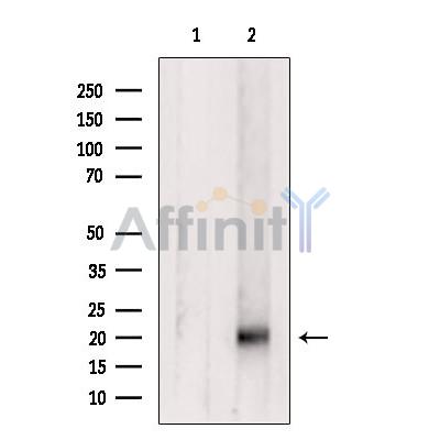 Валидация Affinity DF6299 - 17611