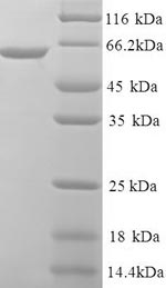 SDS-PAGE