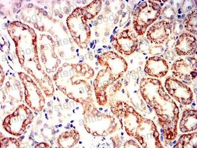 Валидация AntibodySystem RHG85602 (3098)