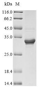 SDS-PAGE