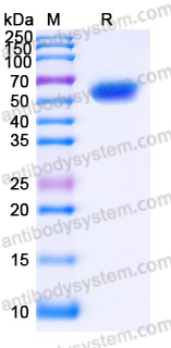 EHK32302, SDS-PAGE