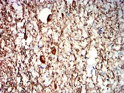 Валидация AntibodySystem RHC91704