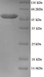 SDS-PAGE
