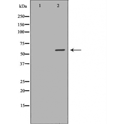 Валидация Affinity DF6383 - 17741