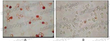 Валидация AntibodySystem RVV44501 (4206)