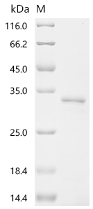 SDS-PAGE