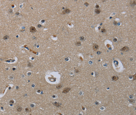 Валидация Elabscience E-AB-11403