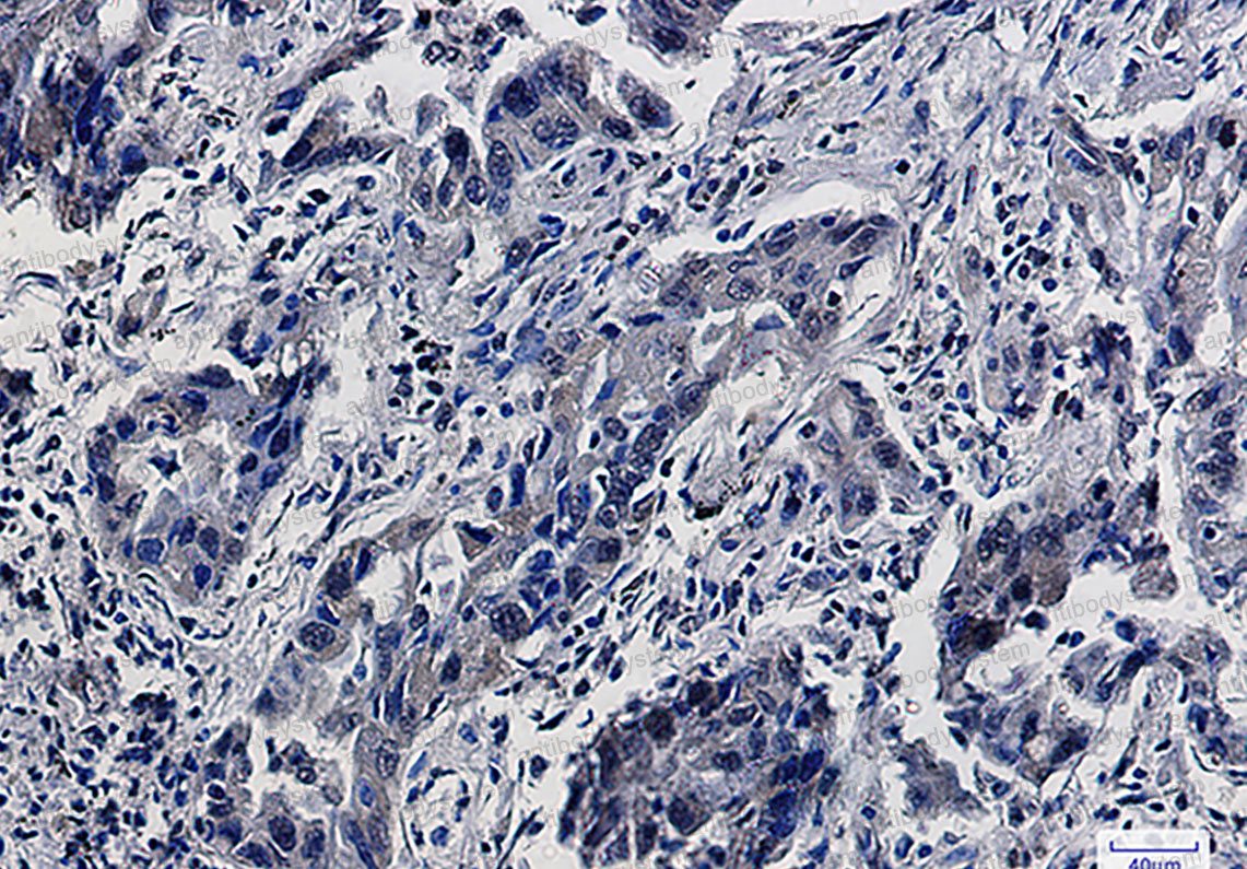 Валидация AntibodySystem RHJ46101