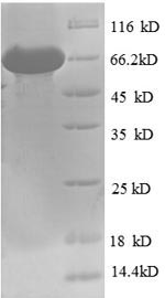 SDS-PAGE