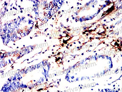 Валидация AntibodySystem RHH16102 (3200)