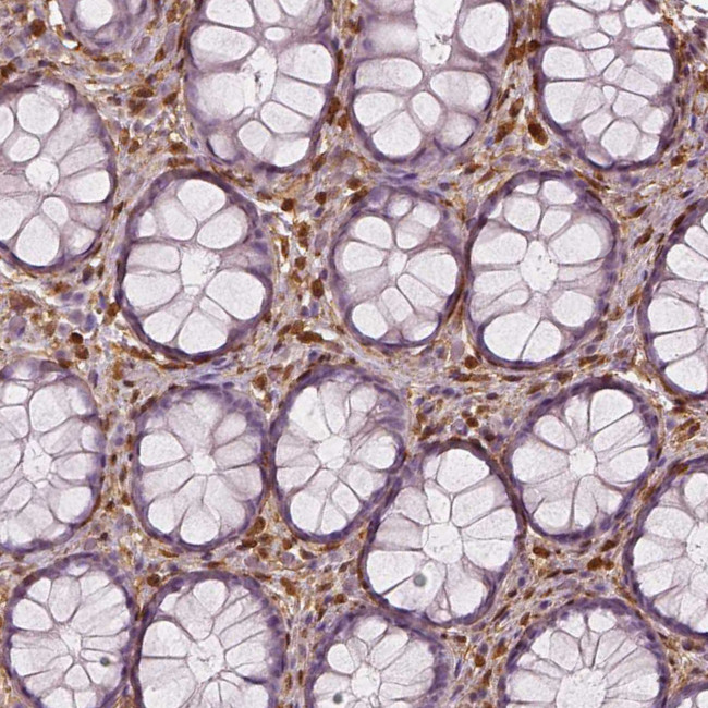 Валидация AssayVector ARM1183(506)