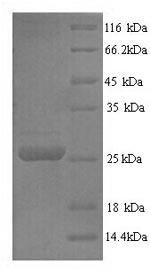 SDS-PAGE