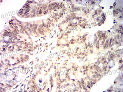 Валидация AntibodySystem RHF98202