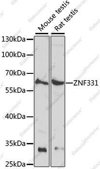 Вестерн-блоттинг, ZNF331, различные клеточные линии