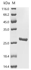 SDS-PAGE