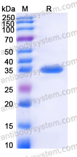 YHF07001, SDS-PAGE