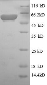 SDS-PAGE