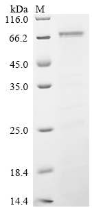 SDS-PAGE