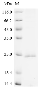 SDS-PAGE
