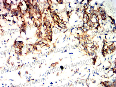 Валидация AntibodySystem RHD32002