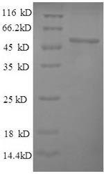 SDS-PAGE