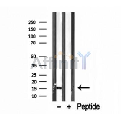 Валидация Affinity DF12115 - 6253
