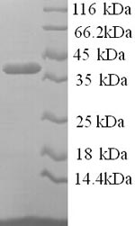 SDS-PAGE