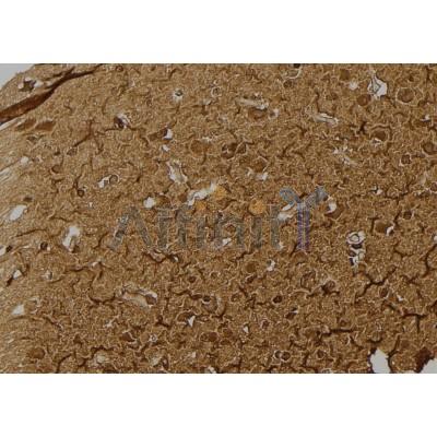 Валидация Affinity DF6946 - 18562