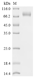 SDS-PAGE