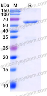 YHC05303, SDS-PAGE