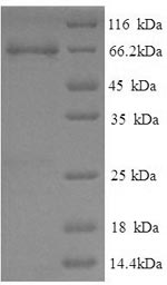 SDS-PAGE