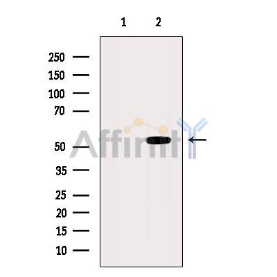 Валидация Affinity DF6586 - 18028