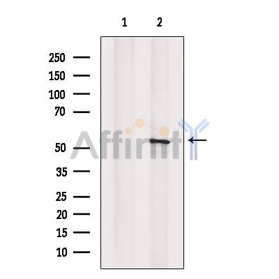 Валидация Affinity DF13309 - 8460