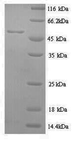 SDS-PAGE