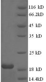 SDS-PAGE