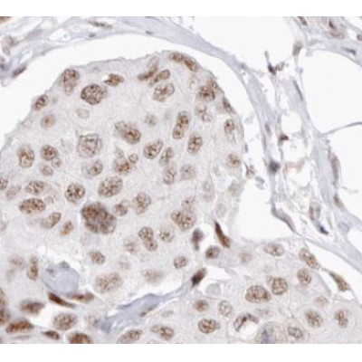 Валидация Affinity AF5357 - 2965