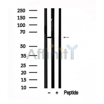 Валидация Affinity AF7581 - 4245