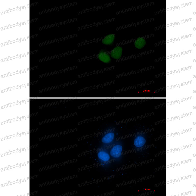 Валидация IF - AntibodySystem RHD30601
