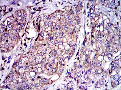 Валидация AntibodySystem RHC13909 (664)