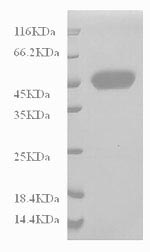 SDS-PAGE