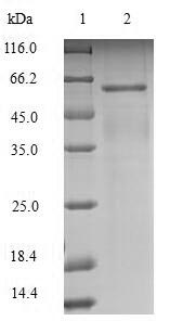 SDS-PAGE