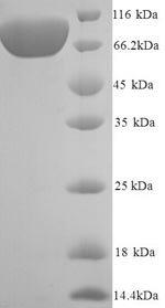 SDS-PAGE