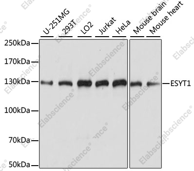Вестерн-блоттинг, ESYT1, различные клеточные линии