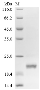 SDS-PAGE